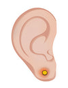 betændelse ved øreringe