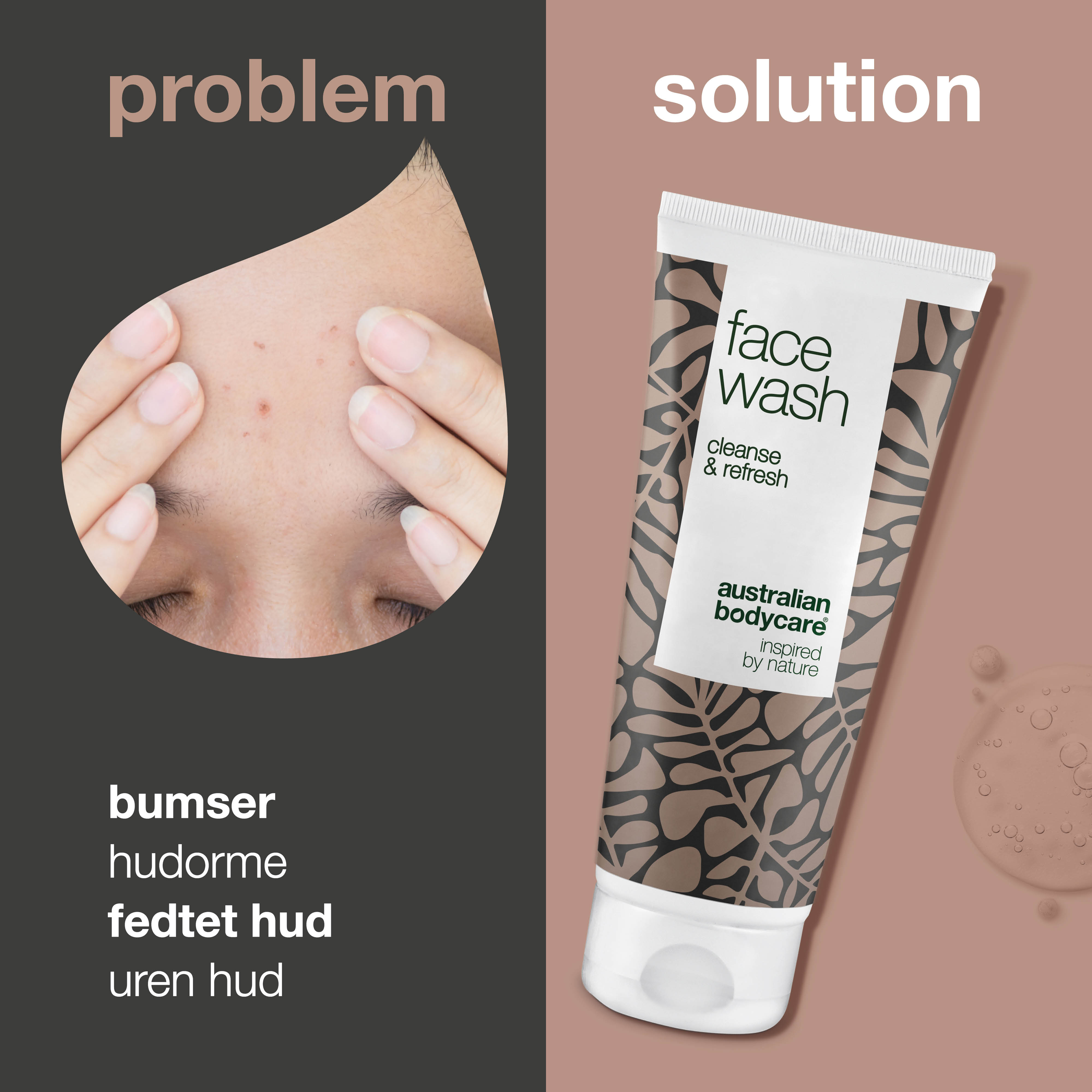 Ansigtsrens til bumser og uren hud — Daglig ansigtsvask til fedtet og uren hud til både mænd og kvinder