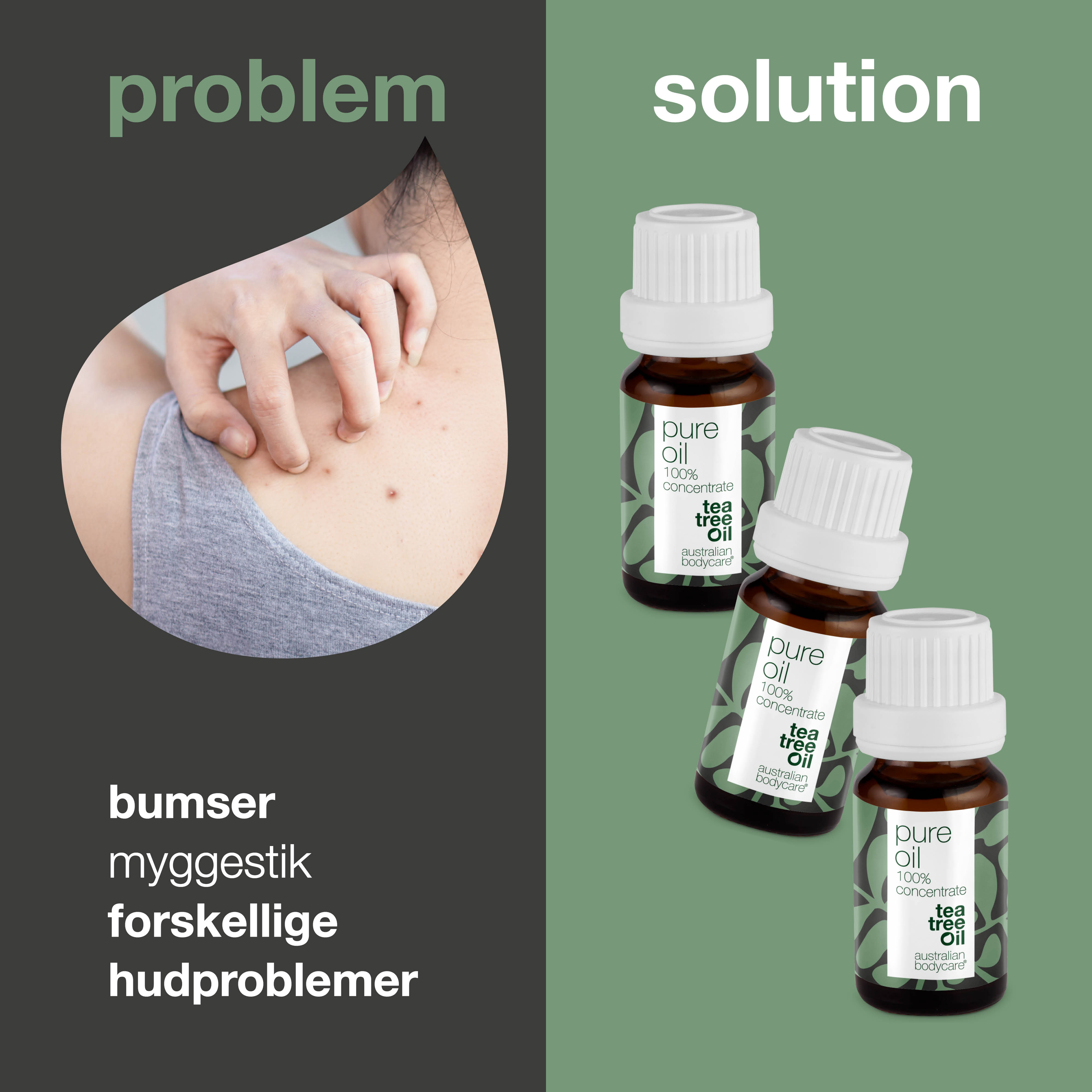 3 stk. XL 30 ml Tea Tree Oil til hudproblemer — 3-pak med 100% koncentreret og ufortyndet Tea Tree Oil fra Australien