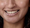 Model som viser sine tænder