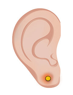 Bliv betændelse ved ørering kvit – mere her
