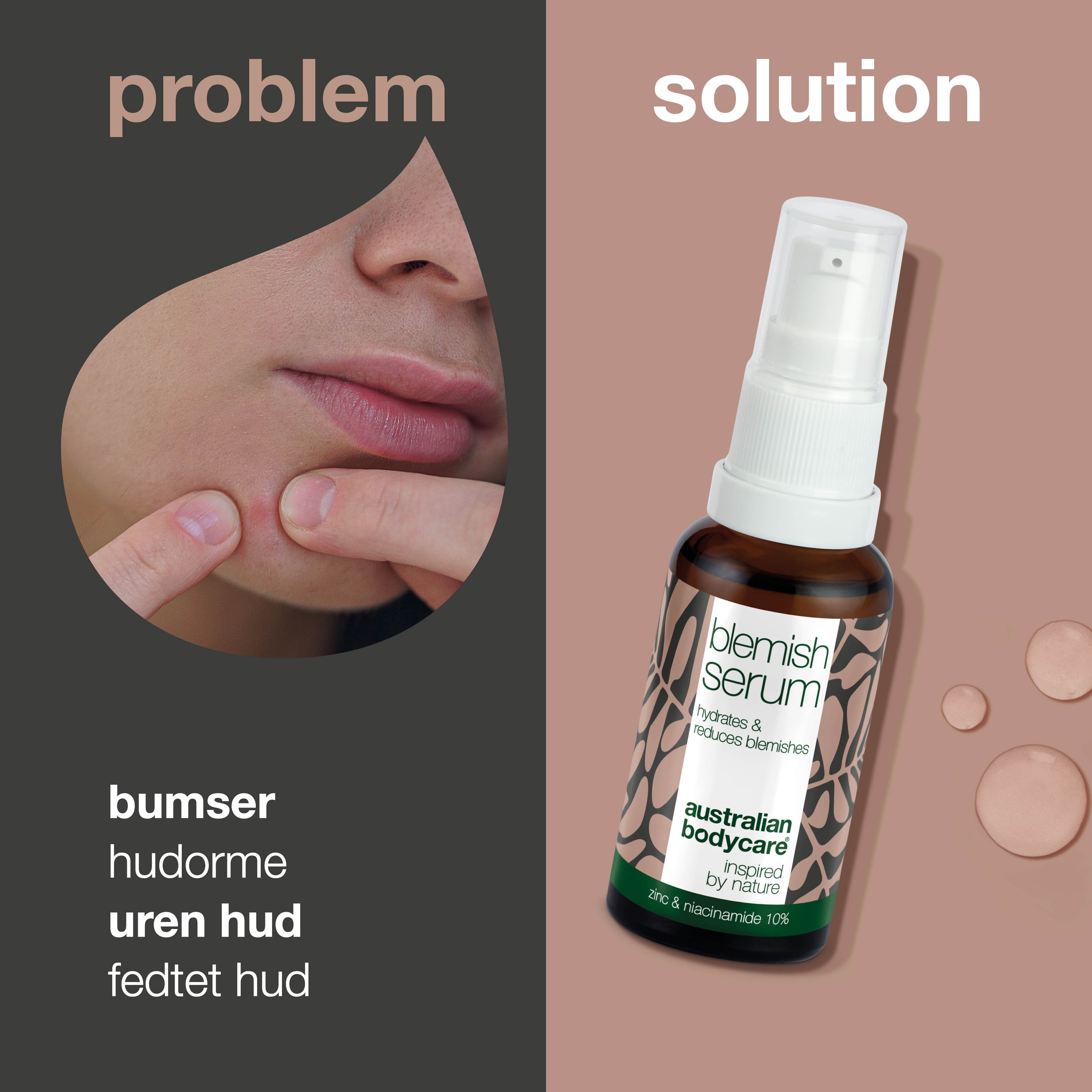 Niacinamide serum til bumser og uren hud — Med Niacinamid 10%, Zink 1% og Tea Tree Oil til uren & fedtet hud