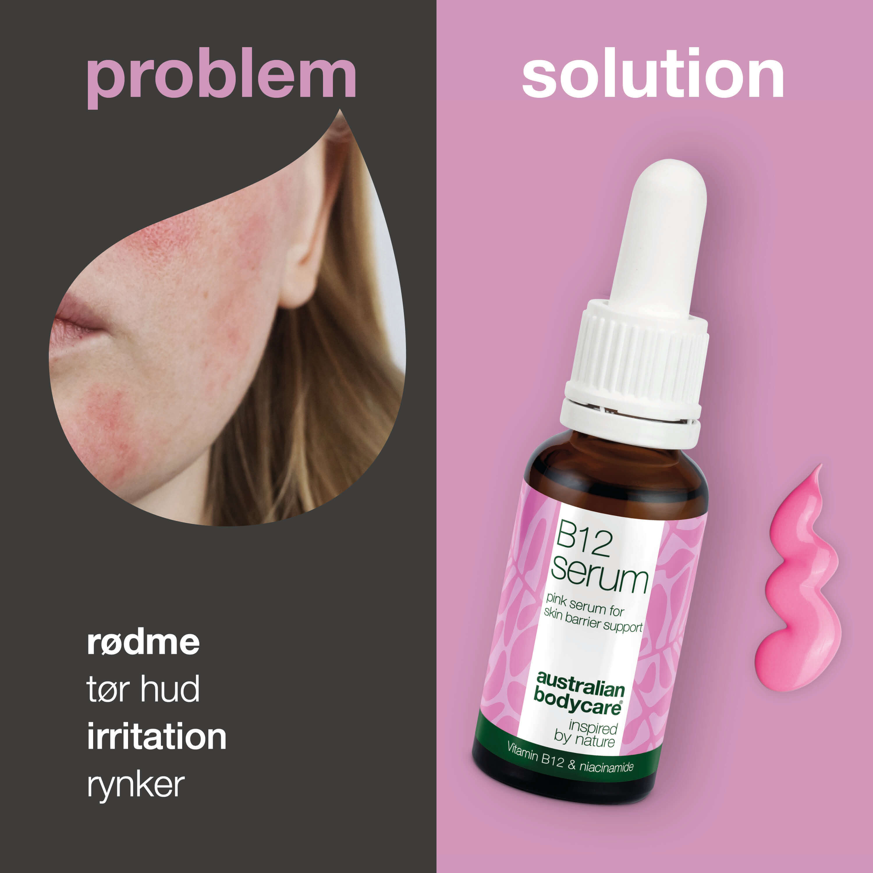 Før  billede, viser rødme, som Pink serum hjælper mod