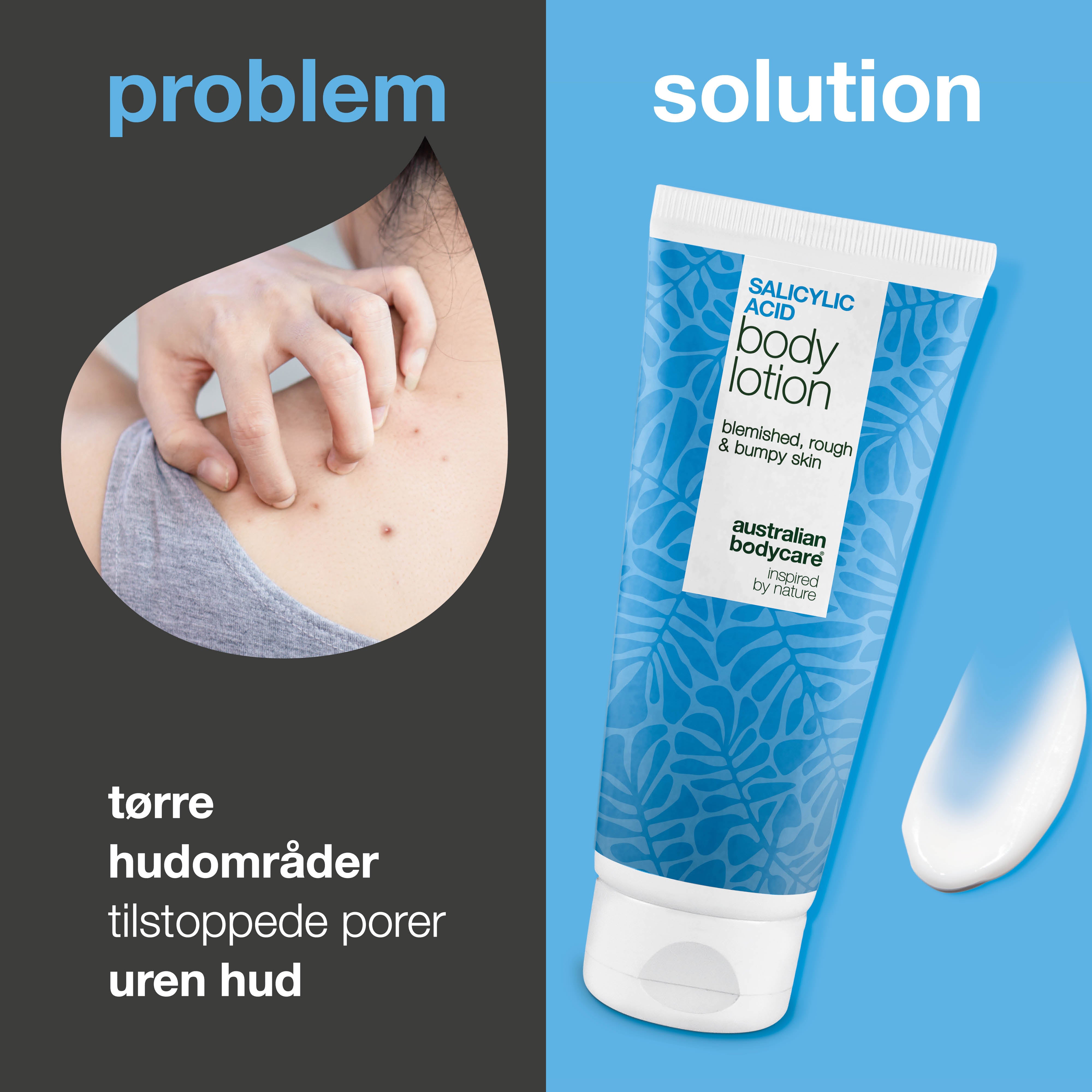 Body Lotion med salicylsyre – mod bumser og tør hud — Body lotion med salicylsyre eksfolierer, fugter og reducerer bumser, uren hud og tørre områder. Perfekt til daglig hudpleje.