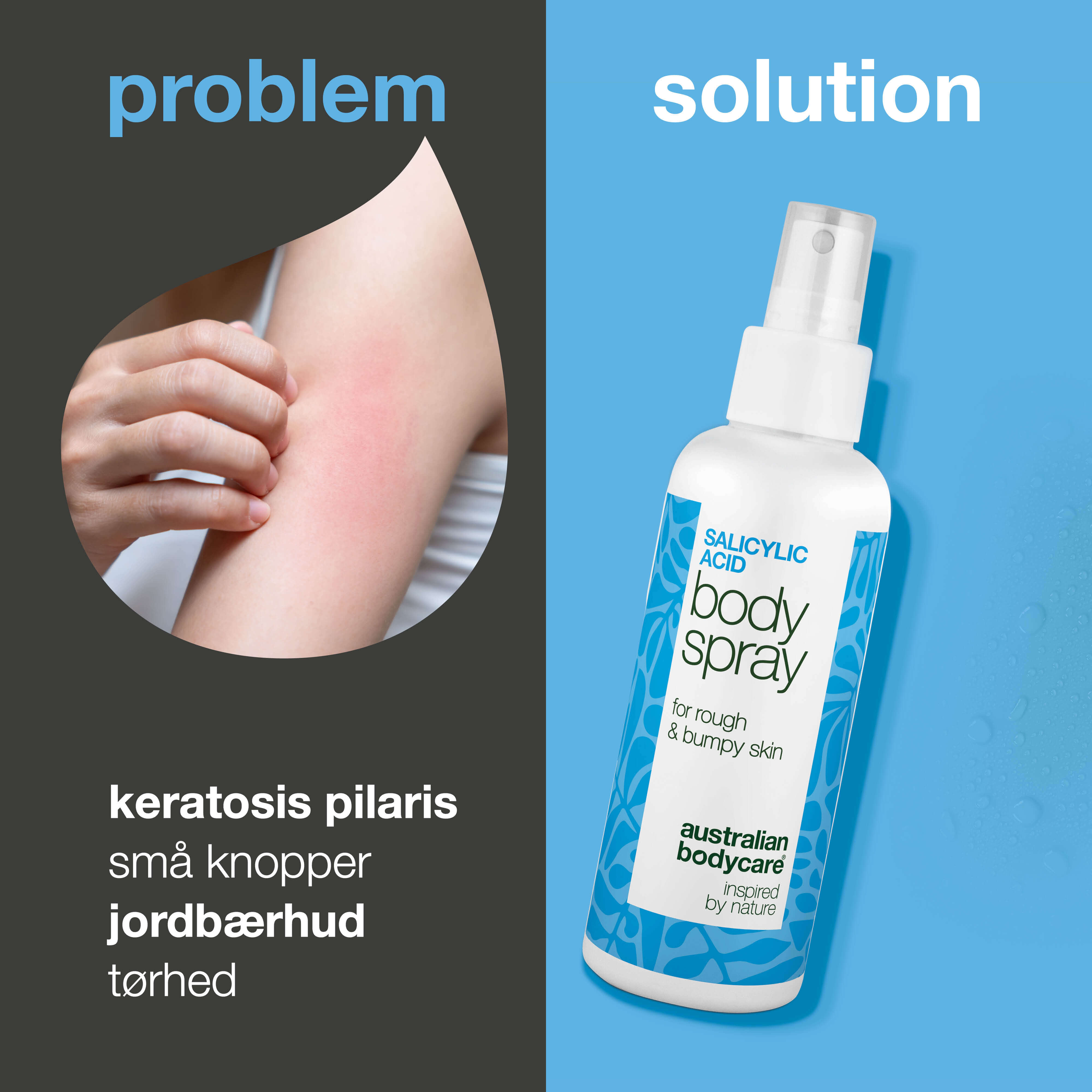 Keratosis Pilaris Spray mod knopper og ru hud på kroppen — Keratosis pilaris spray reducerer knopper og ujævn hud. Bruges dagligt – indeholder effektiv salicylsyre.