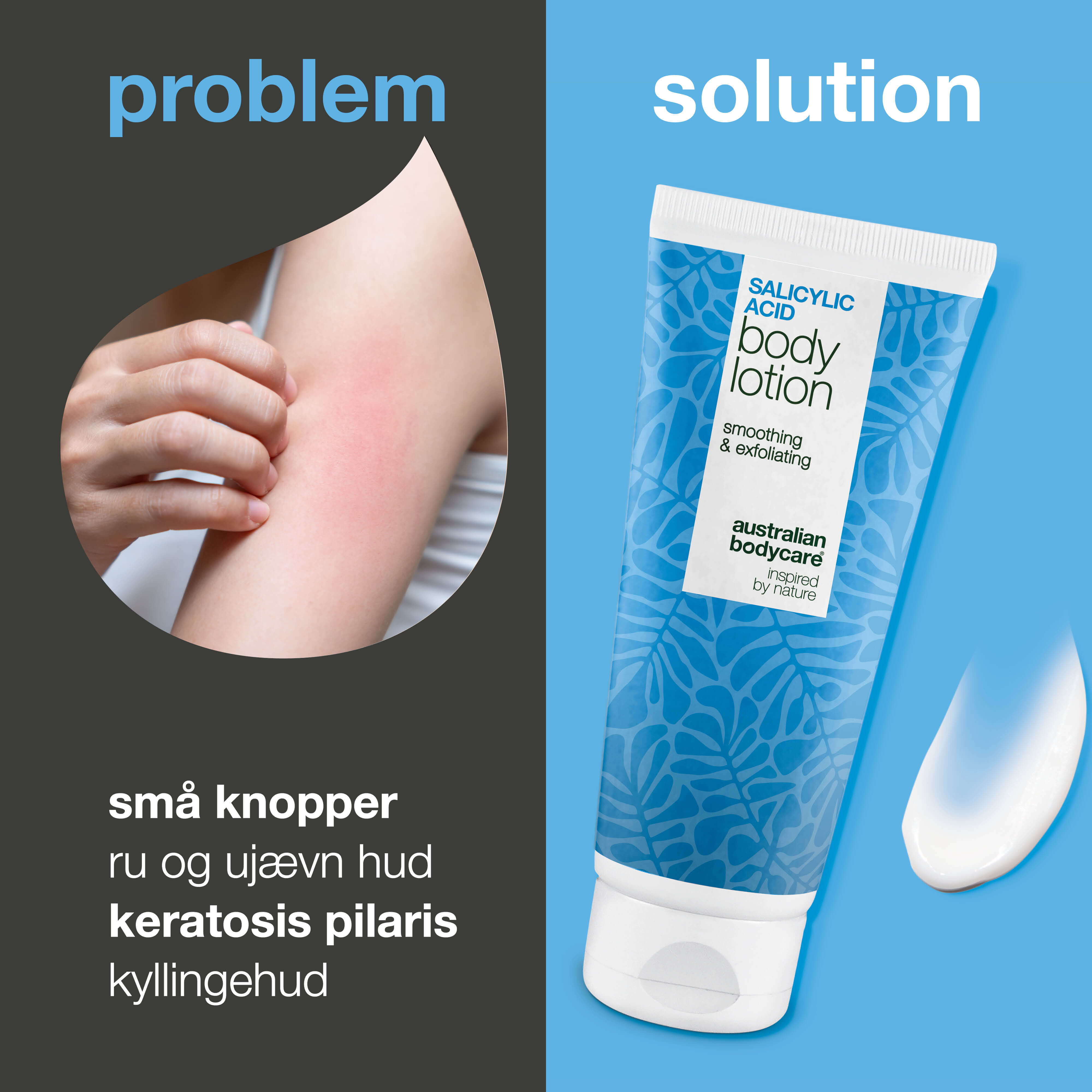 Body lotion mod keratosis pilaris og ru hud med små knopper — Body lotion mod keratosis pilaris og tør hud. Udglatter med salicylsyre, niacinamid og zink.