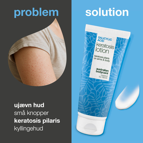 Australian Bodycare Body Lotion til sensitiv hud