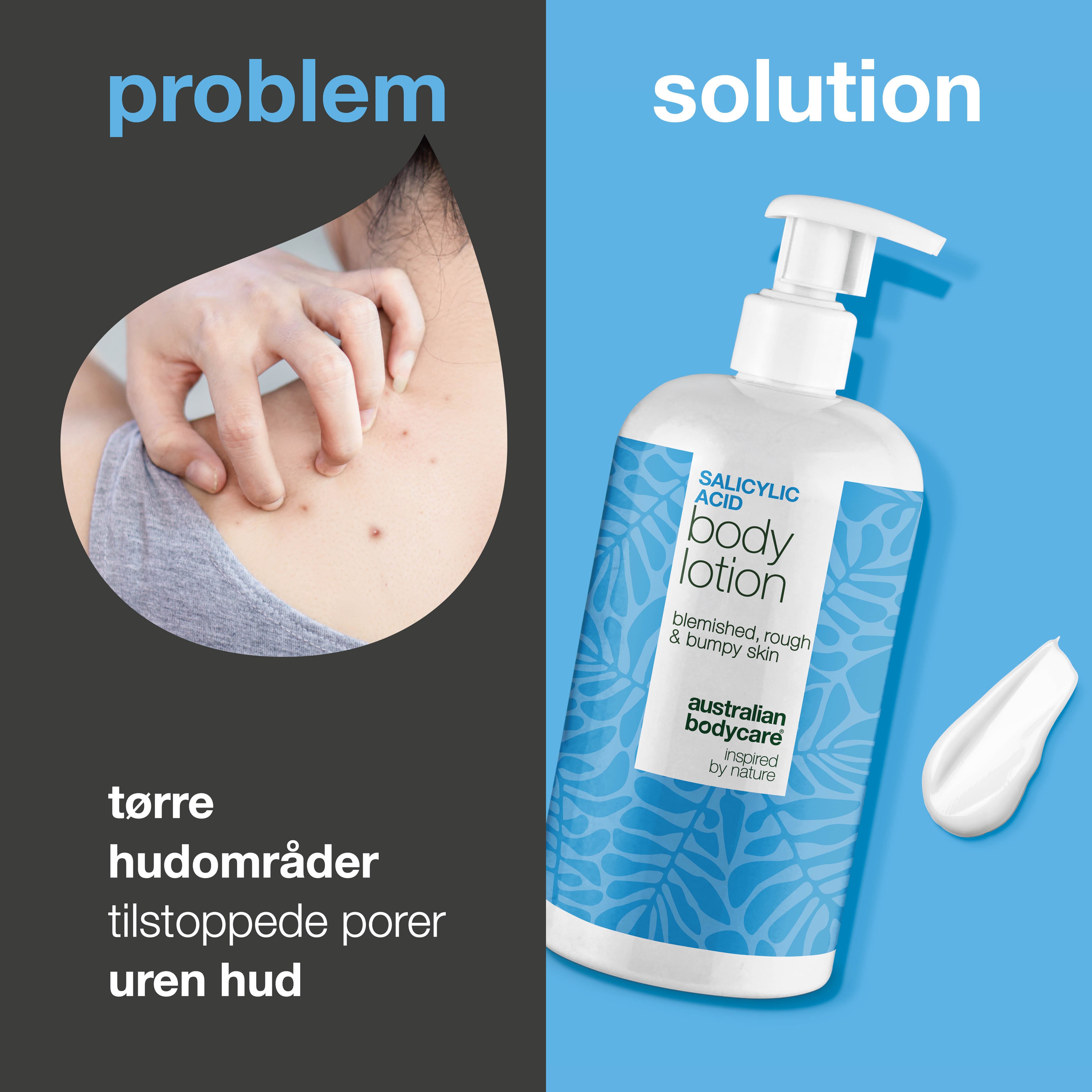 Body Lotion med salicylsyre – mod bumser og tør hud — Body lotion med salicylsyre eksfolierer, fugter og reducerer bumser, uren hud og tørre områder. Perfekt til daglig hudpleje.