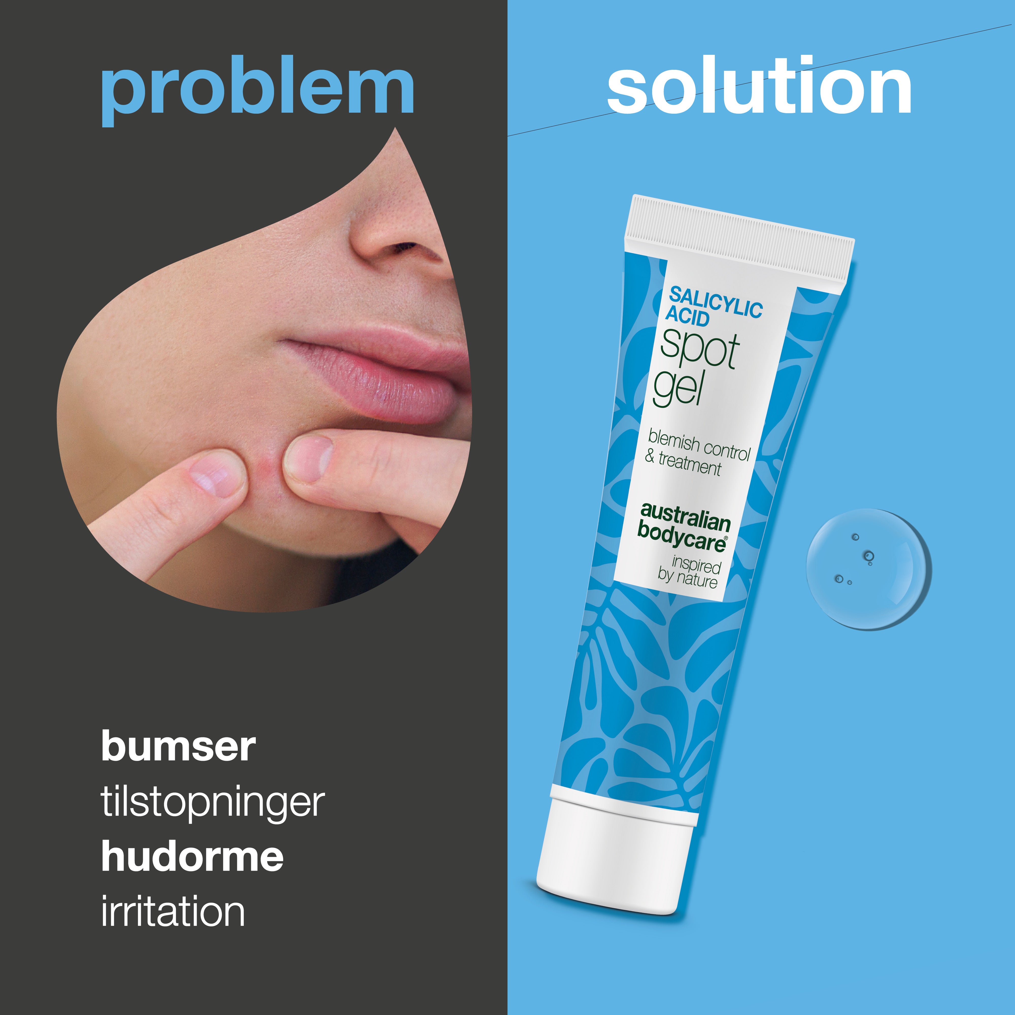 Salicylsyre Spot Gel mod bumser, hudorme og rødme — Salicylsyre Spot Gel til uren hud. Reducerer rødme og tilstopninger med effektiv salicylsyre for en klarere hud.