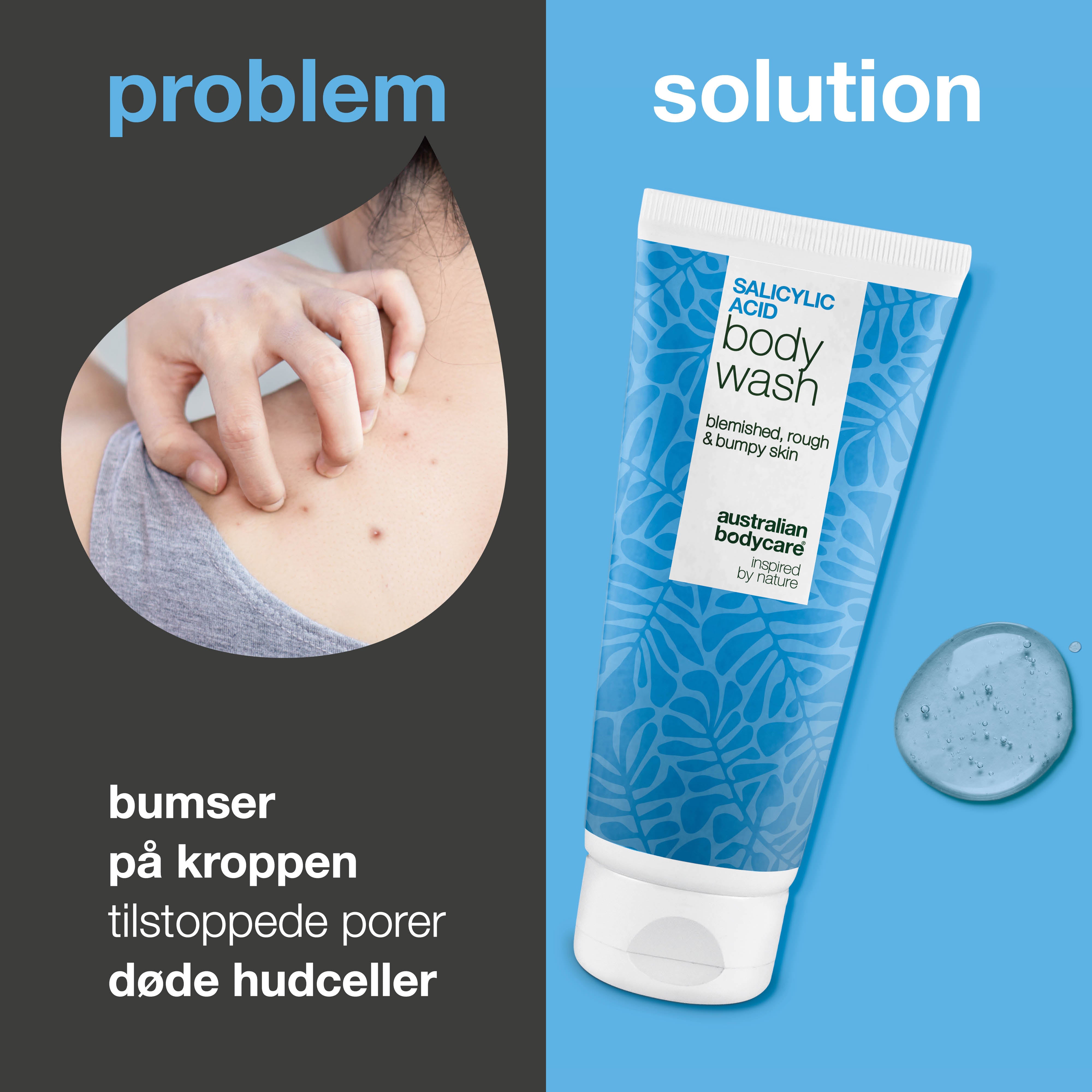 Salicylic acid Body Wash til daglig pleje af bumser, knopper og tilstoppede porer på kroppen. Indeholder salicylsyre, niacinamid og fugtgivende glycerin.