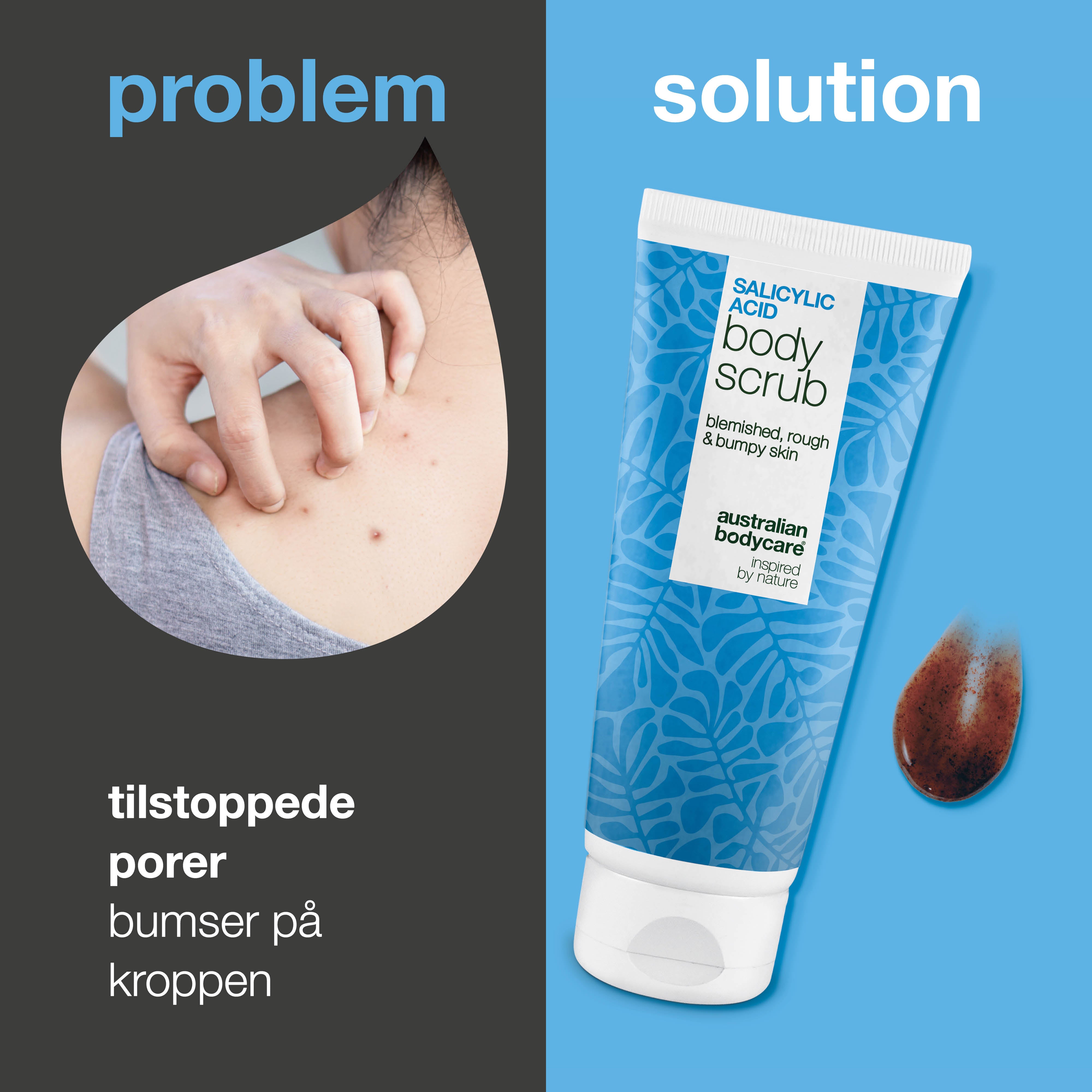 Body Scrub med salicylsyre til uren hud på kroppen – giver glattere hud — Body Scrub med salicylsyre fjerner døde hudceller, bumser og tilstopninger. Indeholder salicylsyre, glykolsyre og allantoin.
