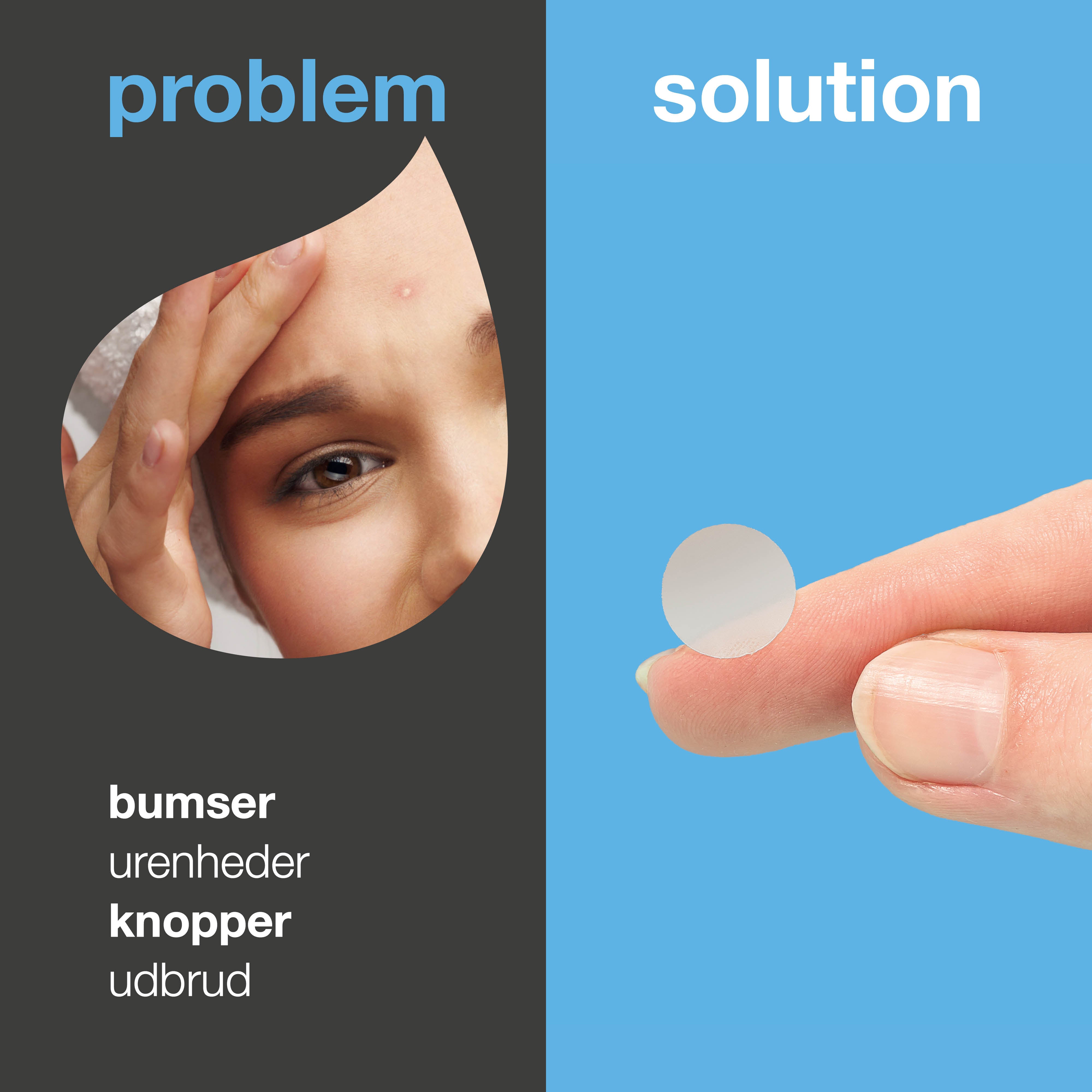 Salicylsyre Pimple Patches til bumser, fedtet hud og inflammation. Renser porer og beskytter huden. Indeholder salicylsyre, hyaluronsyre og Camellia Sinensis.