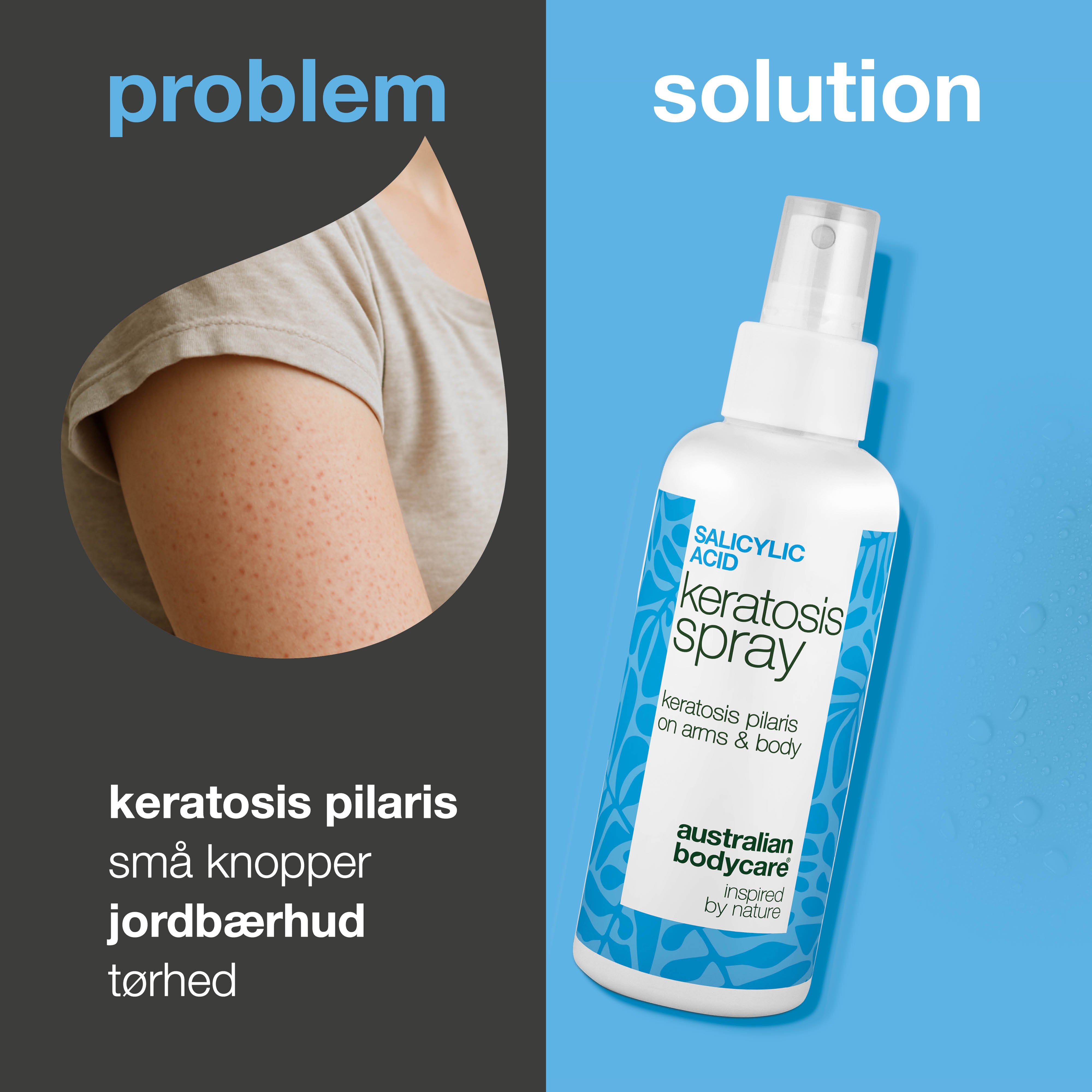 Keratosis Pilaris Spray mod knopper og ru hud på kroppen — Keratosis pilaris spray reducerer knopper og ujævn hud. Bruges dagligt – indeholder effektiv salicylsyre.