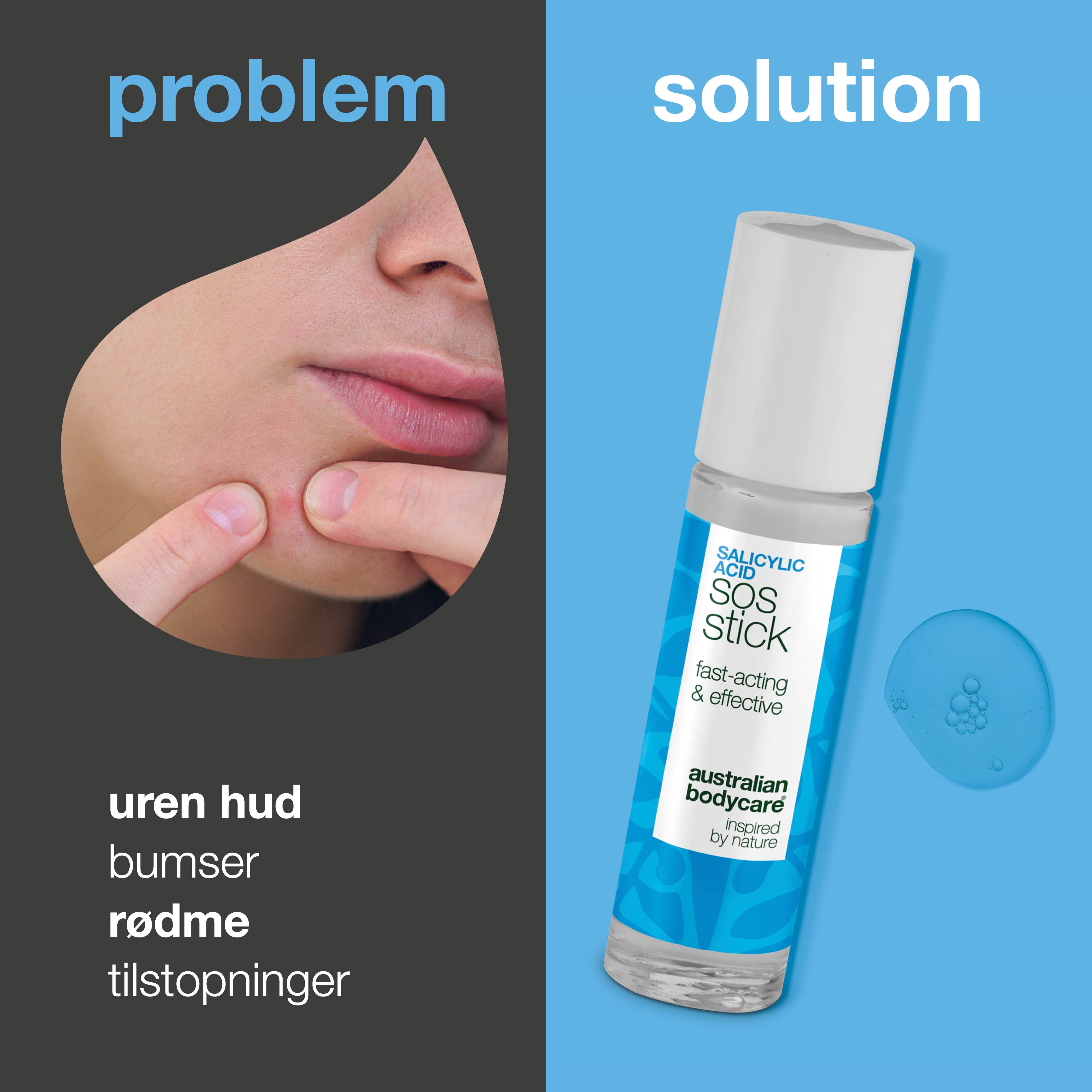 Salicylsyre SOS Stick mod bumser og rødme – reducerer tilstopninger og balancerer huden
