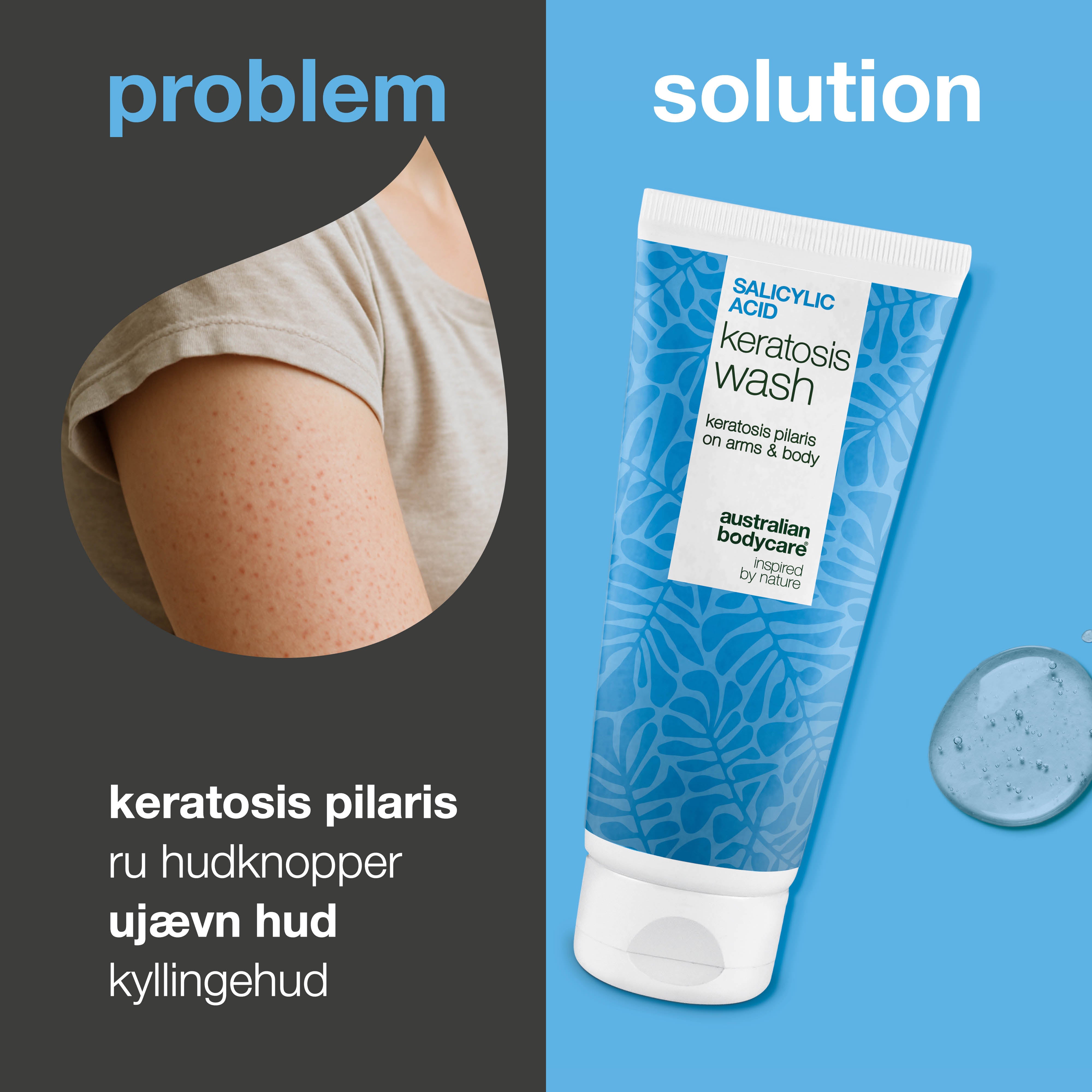 Keratosis Pilaris Body Wash mod tør, ujævn hud og små knopper. Beriget med salicylsyre, niacinamid, zink PCA og glycerin for synligt glattere hud.