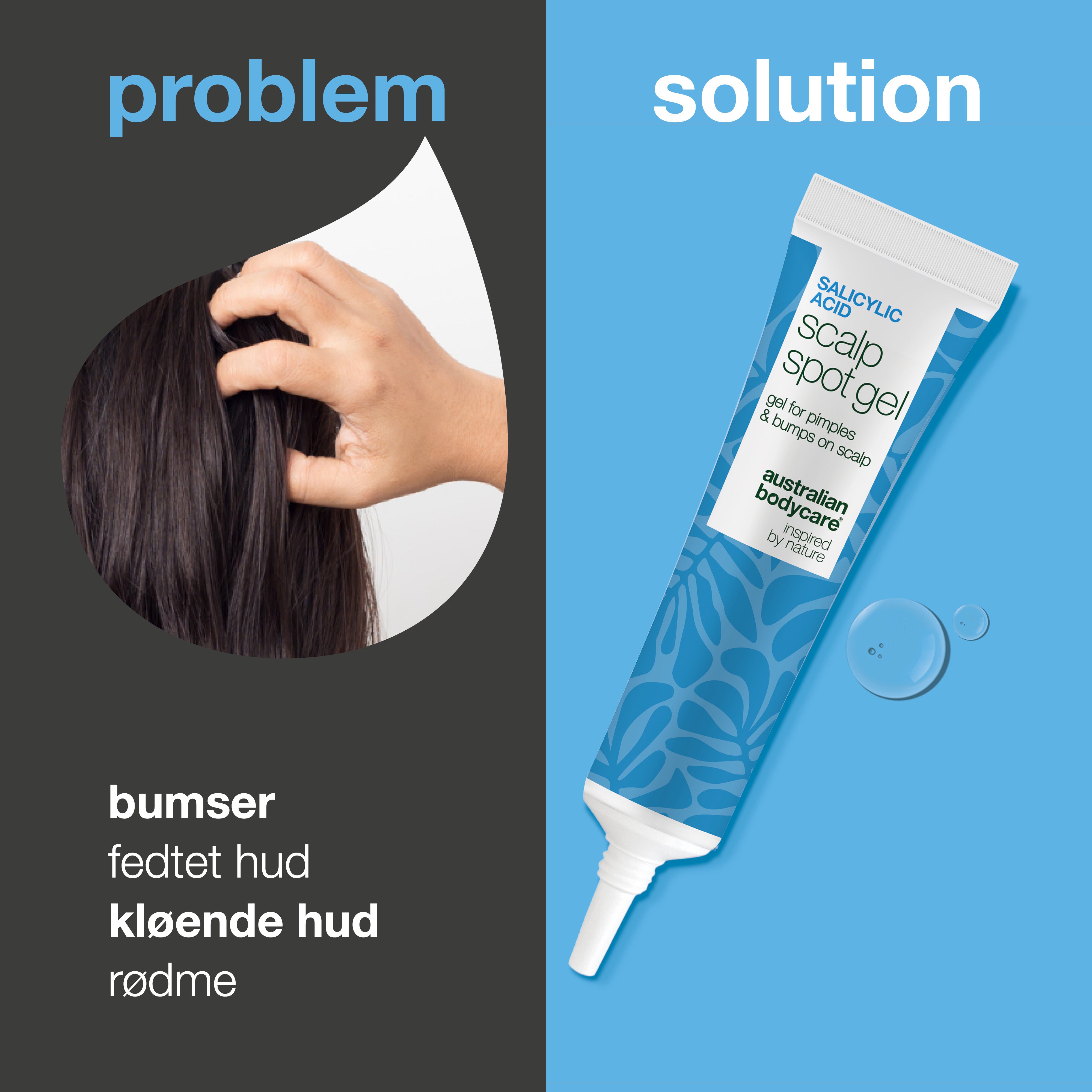 Salicylsyre Gel mod bumser og kløe i hovedbunden — Døjer du med bumser i hovedbunden? Gelen eksfolierer porerne, mindsker olie og beroliger rødme og kløe effektivt.