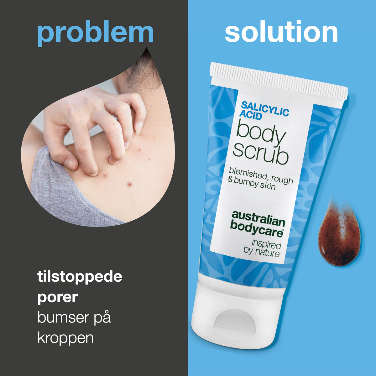Problem og løsning: tilstoppede porer og bumser på kroppen. Til venstre et nærbillede af en skulder med bumser, til højre Salicylic Acid Body Scrub fra Australian Bodycare