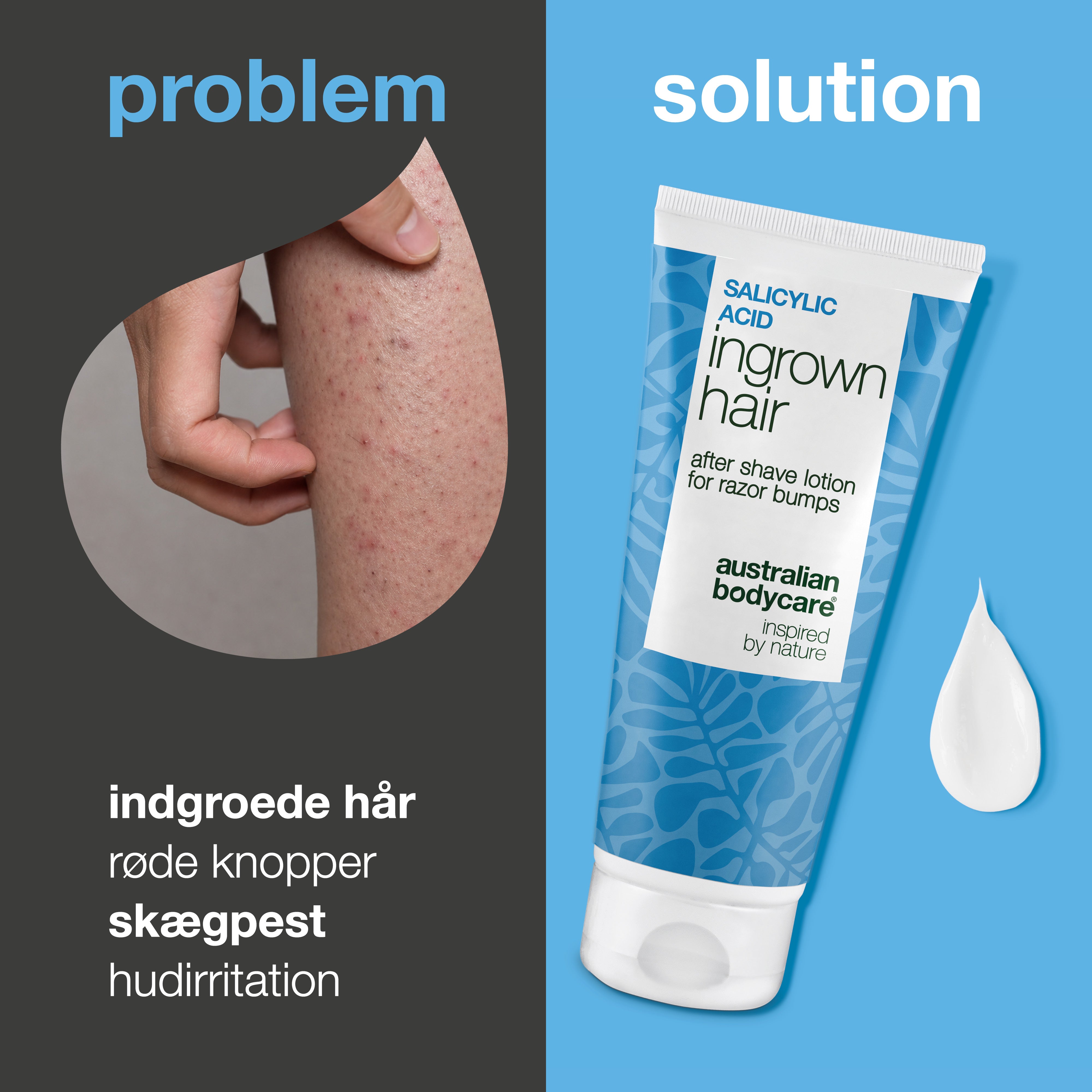 Salicylsyre After Shave Lotion mod indgroede hår, røde knopper og irritation efter barbering. Produktet vises ved siden af hud med synlige røde knopper og indgroede hår.
