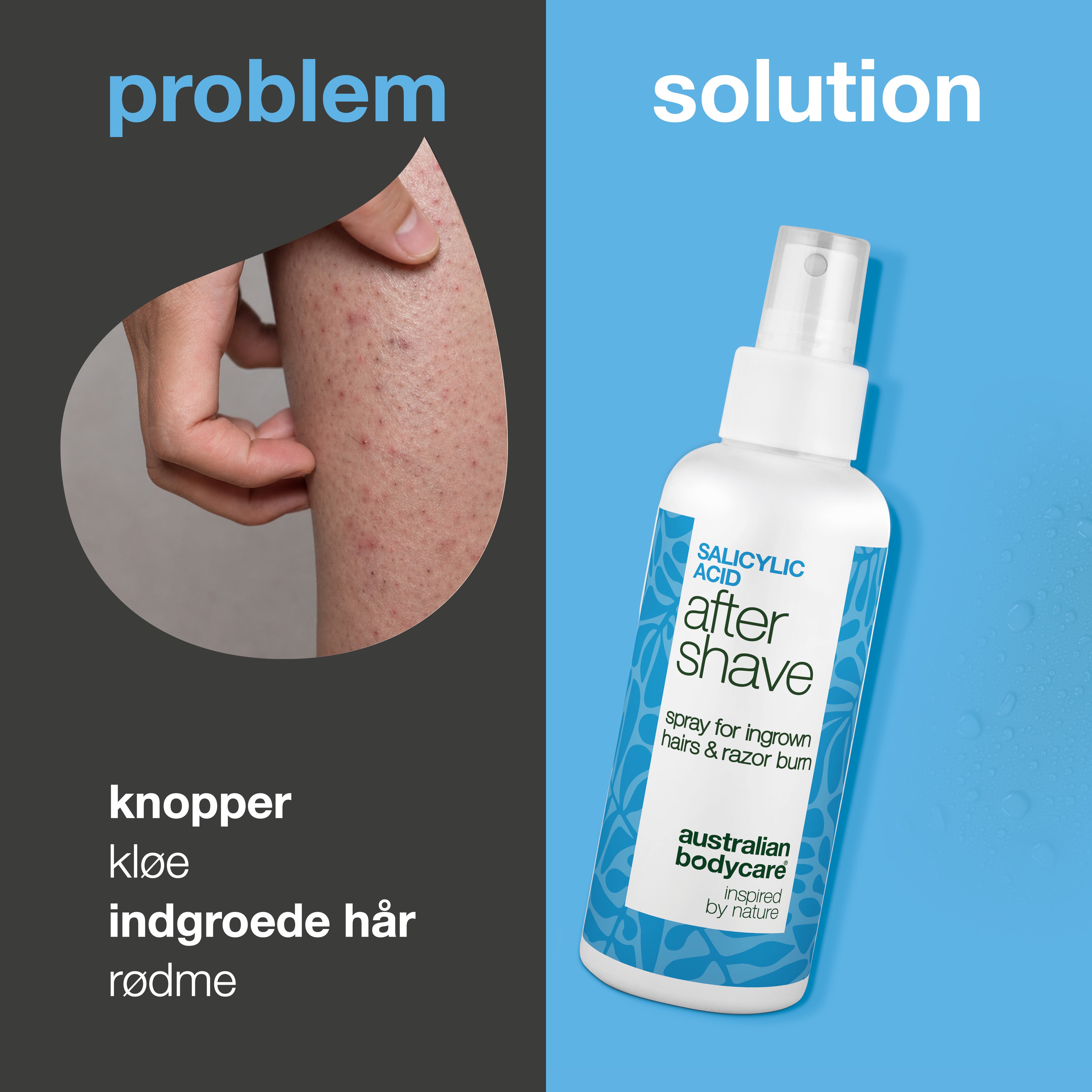 Salicylsyre After Shave Spray til skægpest, razor burn & røde knopper — After Shave Spray til kløe, svie og rødme efter barbering med Salicylsyre, Aloe Vera og Panthenol.