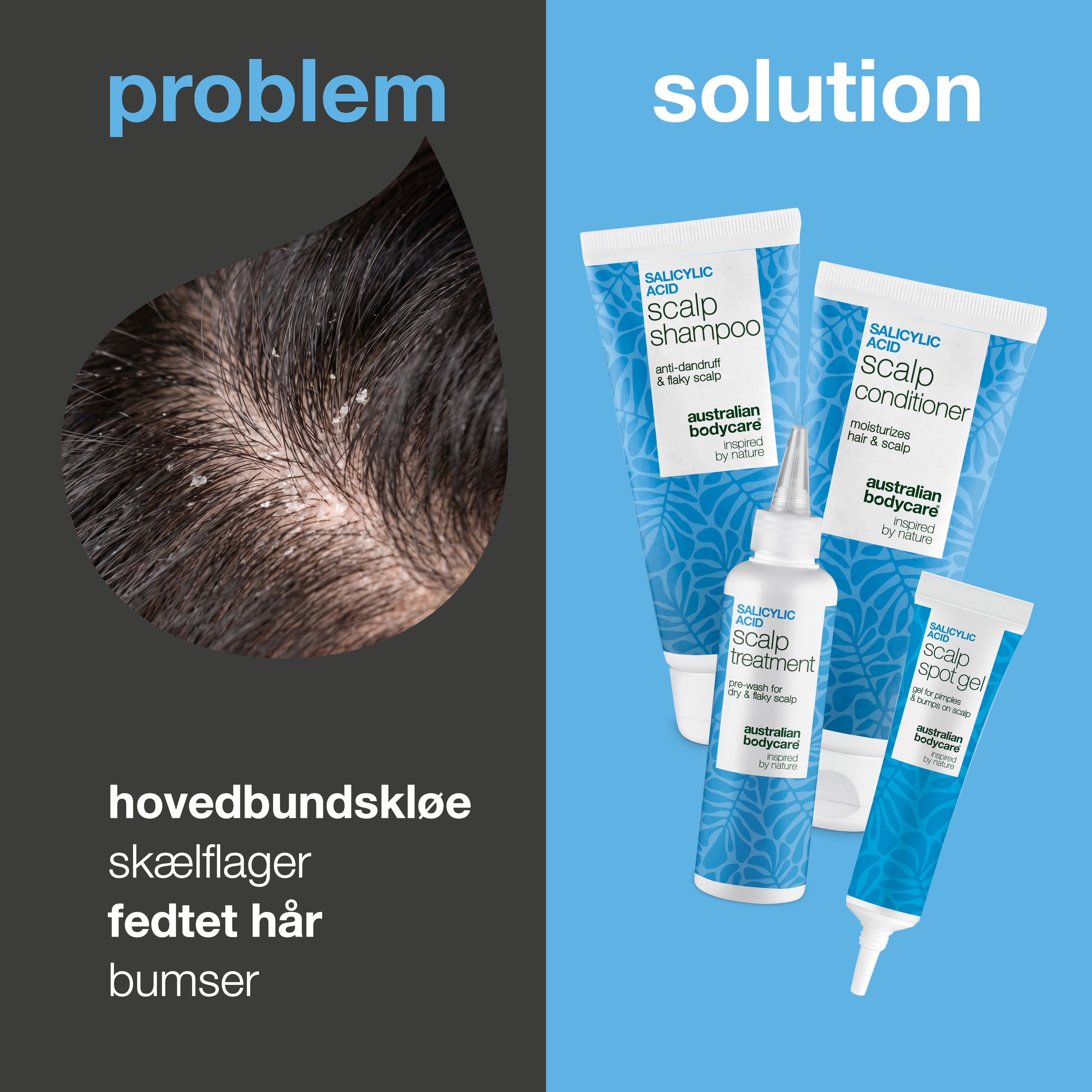 Problem og løsning: nærbillede af skæl og fedtet hovedbund samt de fire produkter i sættet mod kløe, skæl og bumser