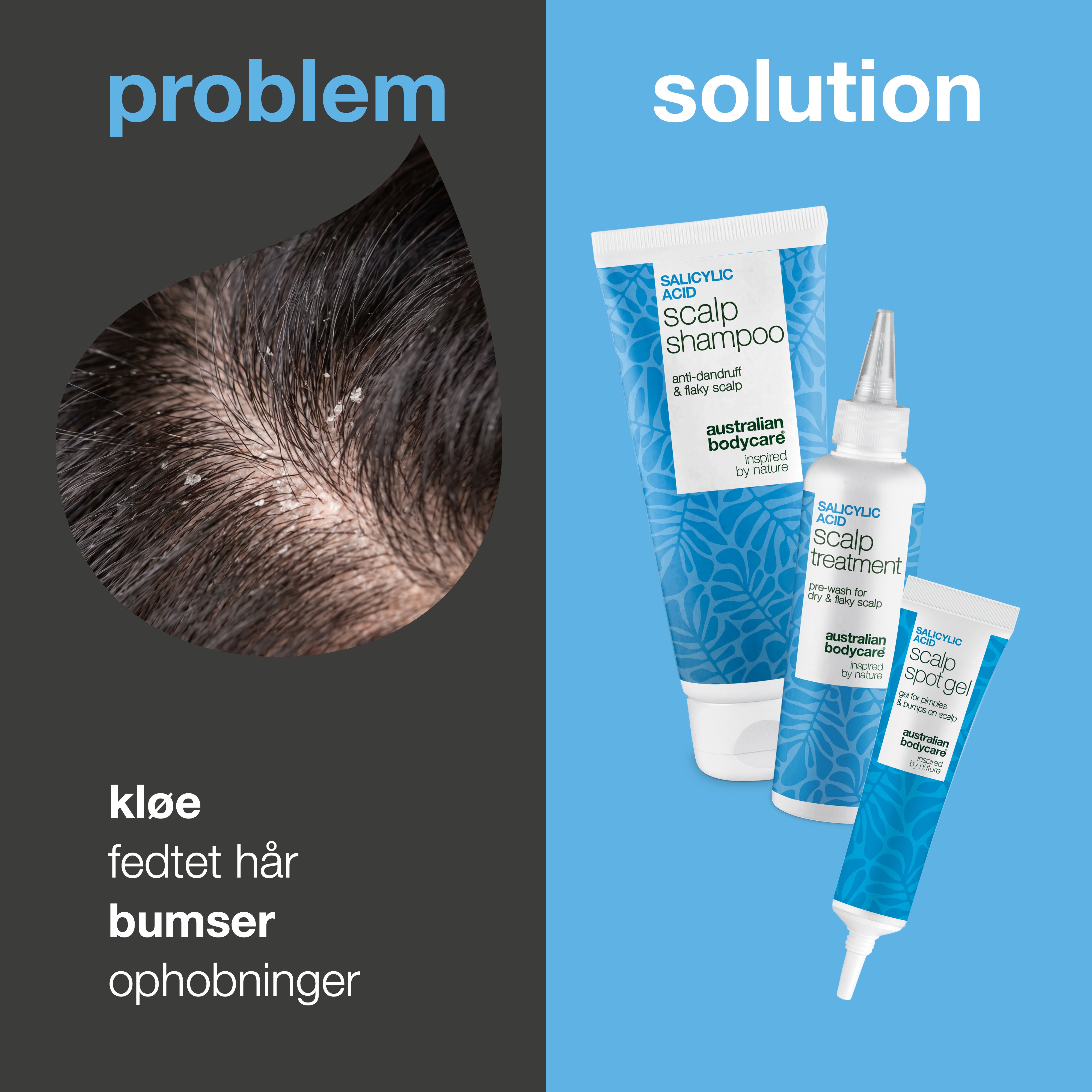 Problem og løsning: nærbillede af kløe, fedtet hår og ophobninger i hovedbunden ved siden af sættets tre produkter