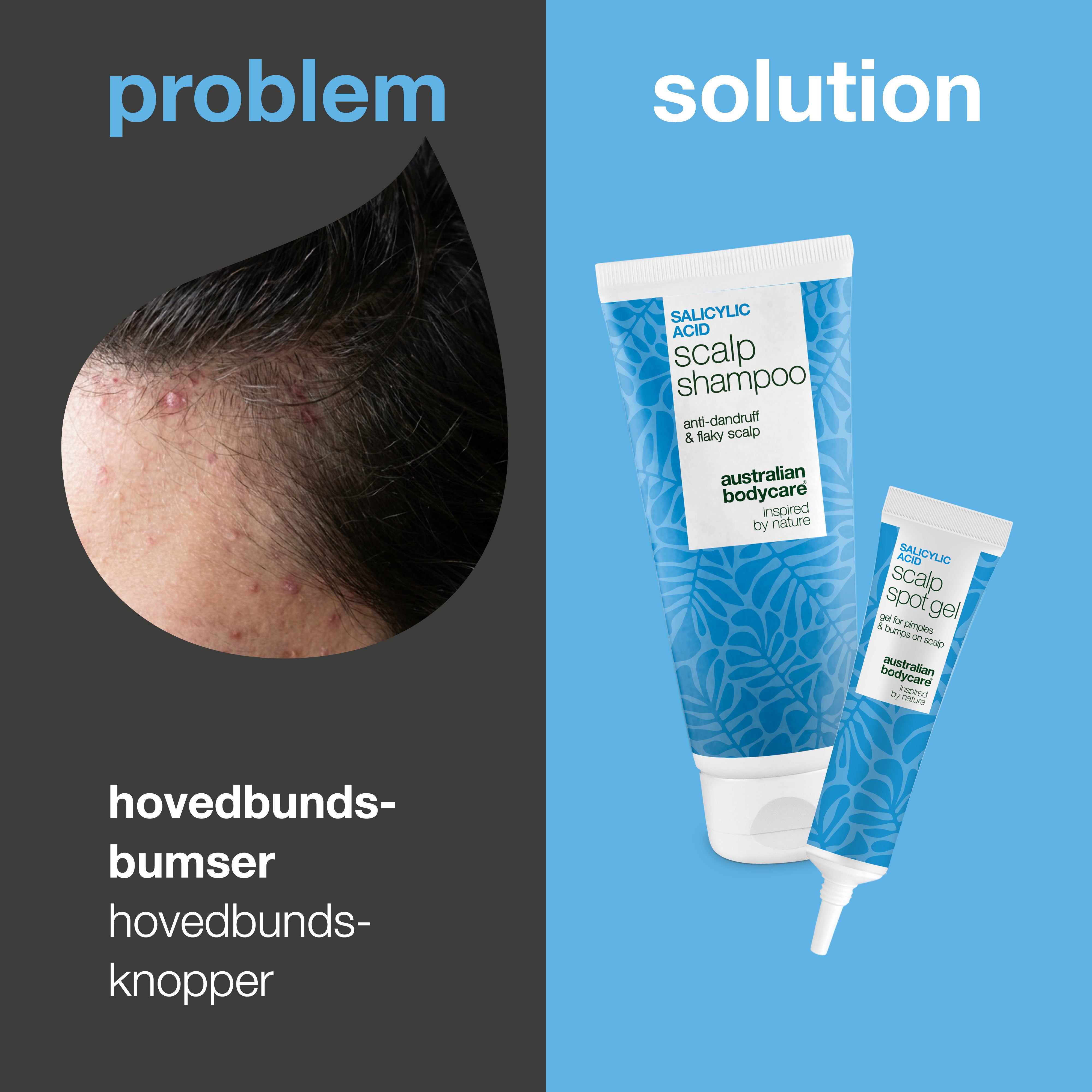 Problem og løsning: nærbillede af bumser og knopper i hovedbunden ved siden af sættets shampoo og spot gel