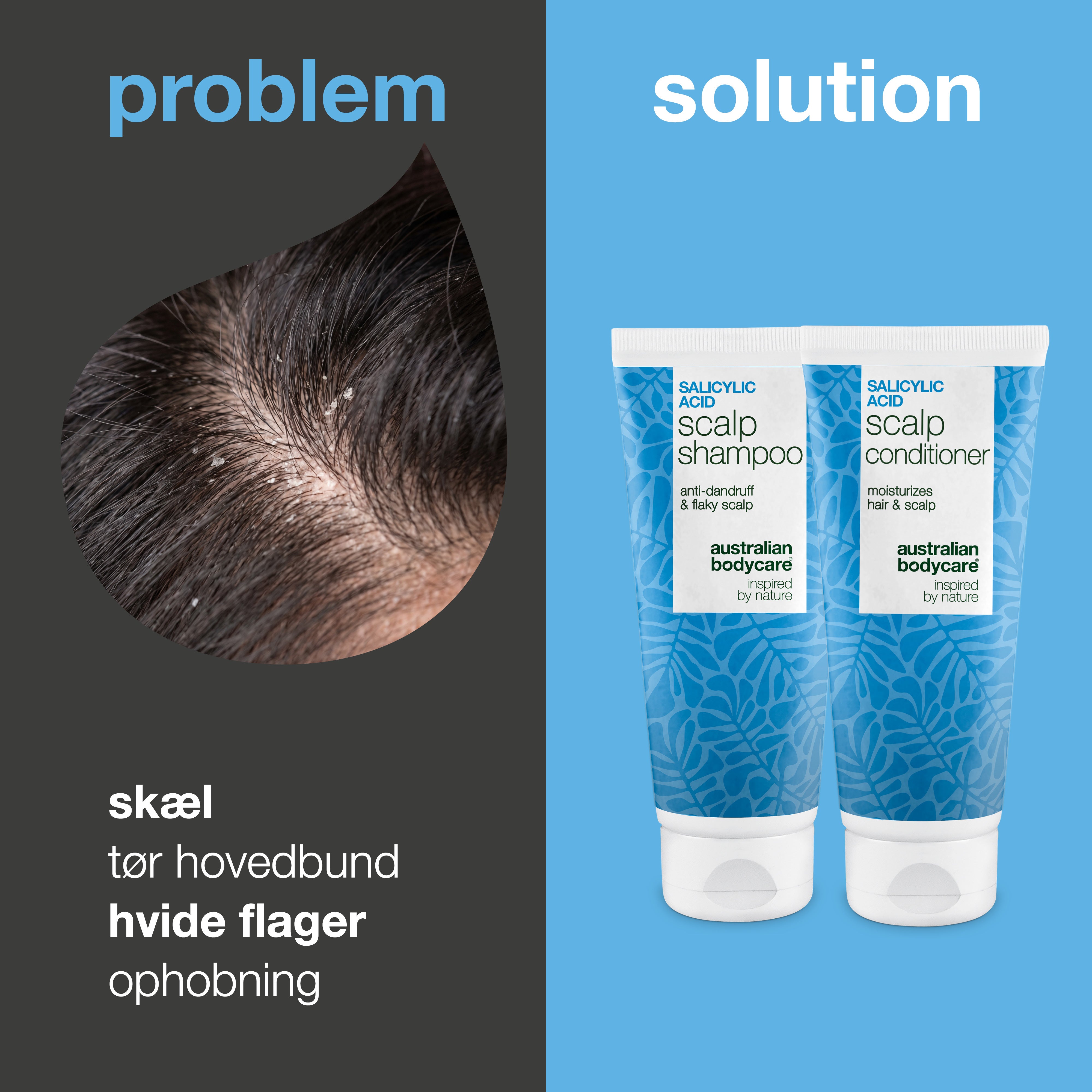 Problem og løsning: nærbillede af skæl og hvide flager i hovedbunden ved siden af skælshampoo og balsam fra sættet