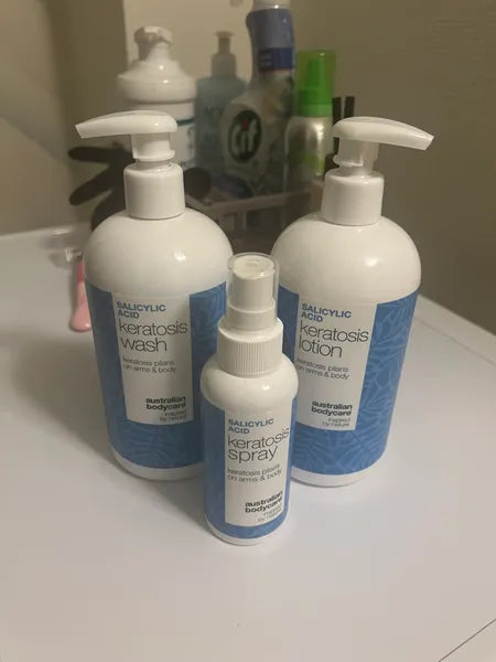 Keratosis pilaris kunderesultat – Isabell C. fra Holland