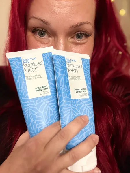 Keratosis pilaris kunderesultat – Viktorija K.