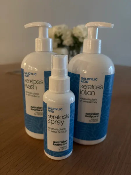 Keratosis pilaris kunderesultat – Walter P.